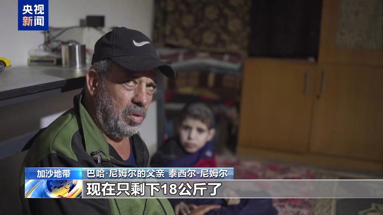 加沙15岁男孩饿到只剩18公斤